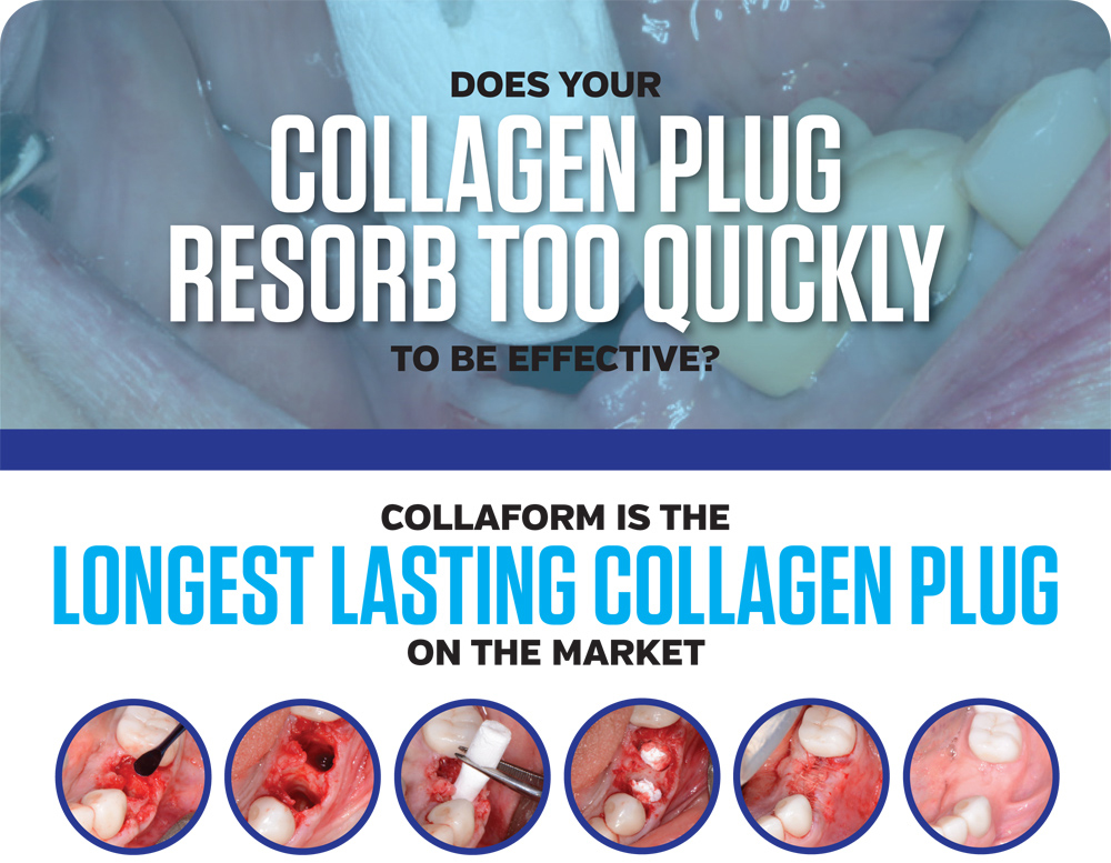 Collagen Plugs