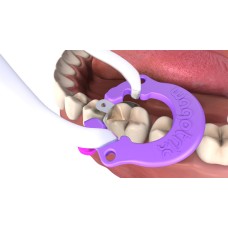 WagoTrix Sectional Matrix Intro Kit ( Purple Single-Use Rings )