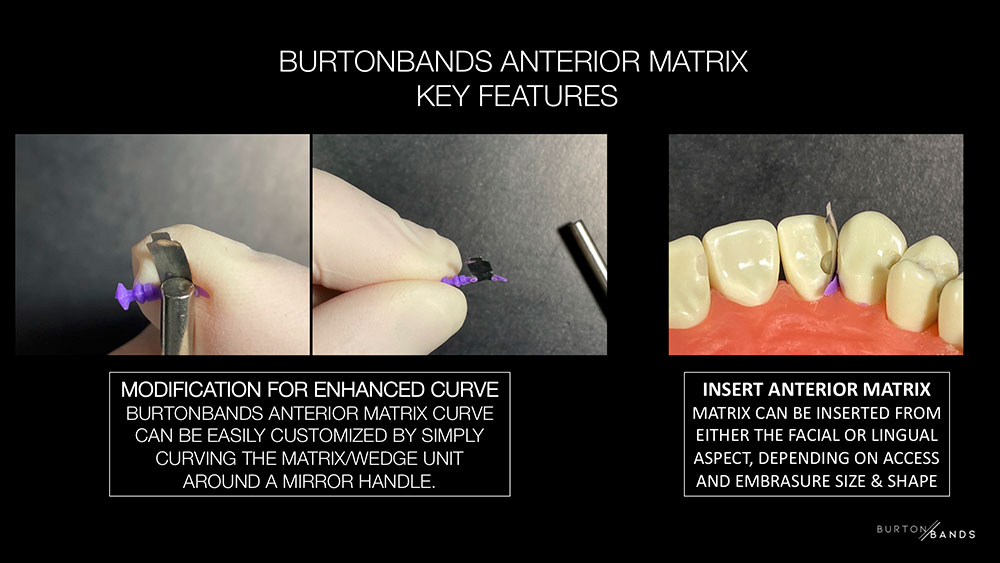 BurtonBands Anterior key features